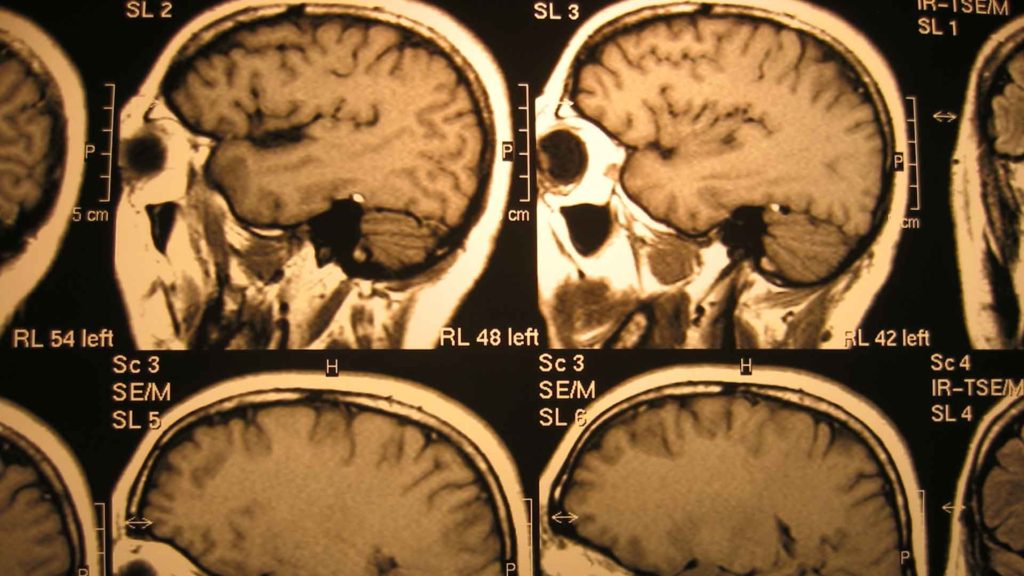MRI-Systems-on-SuccesStuff