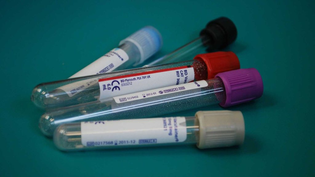 Things-to-Know-About-PCR,-Antibody,-&-Antigen-Tests-on-SuccesStuff