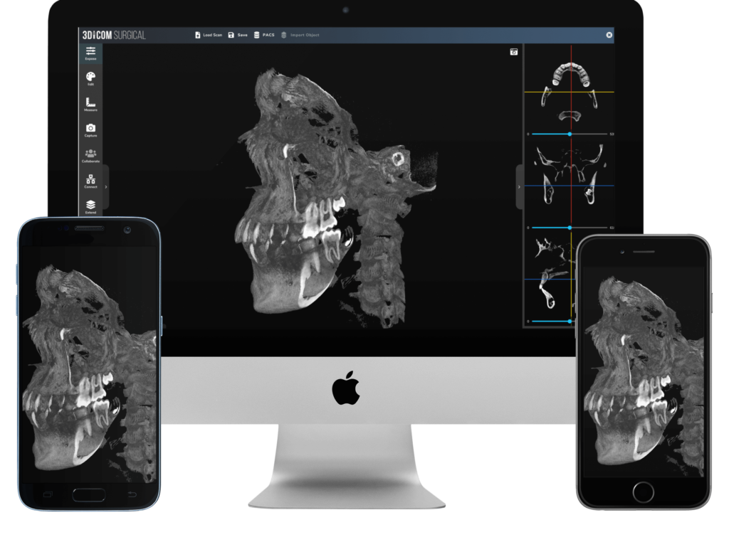 DICOM viewer for iOS